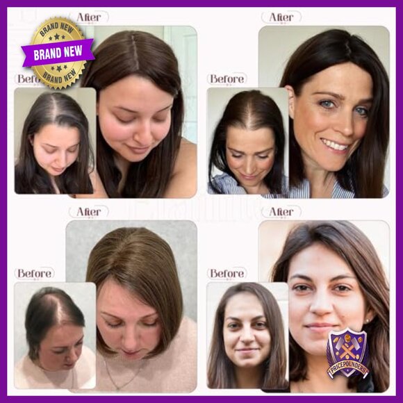 Human Hair Topper 5.1x2.8 Silk Base Clip-In for Thinning Hair 12 Inch main image 6